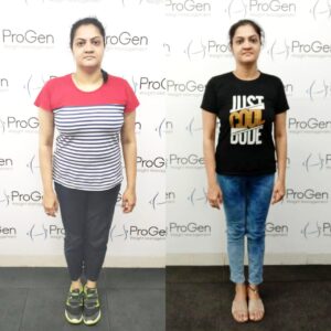 obese weight loss in bangalore