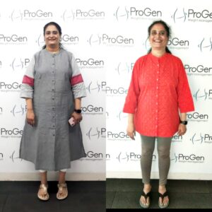 obese weight loss in indiranagar