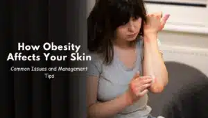 How Obesity Affects Your Skin