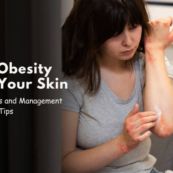 How Obesity Affects Your Skin